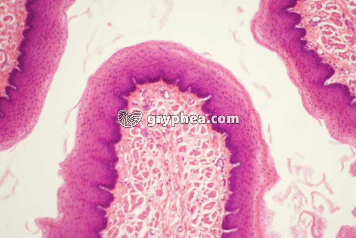 Oesophage - muqueuse oesophagienne x15 - gryphea.org